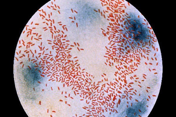 Cảnh báo: 12 loại vi khuẩn kháng kháng sinh đáng sợ đang là mối đe dọa rất lớn đến sức khỏe con người - Ảnh 13.