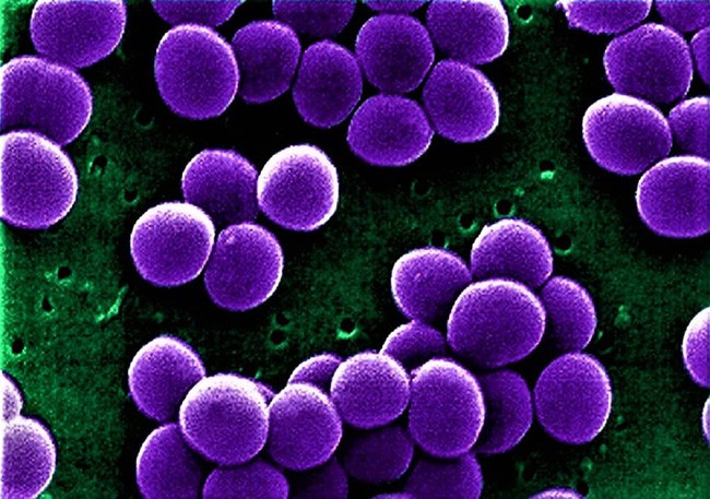 Cảnh báo: 12 loại vi khuẩn kháng kháng sinh đáng sợ đang là mối đe dọa rất lớn đến sức khỏe con người - Ảnh 7.