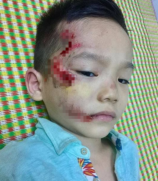 Mẹ trẻ tố y tá ngồi buôn điện thoại, bỏ mặc con trai bị thương vì không kịp mang tiền đóng viện phí - Ảnh 2.