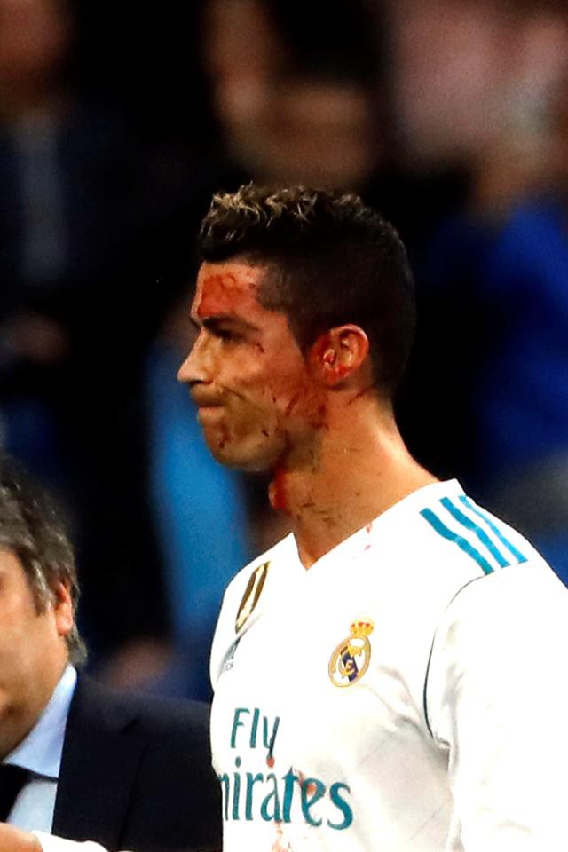 Ronaldo mượn điện thoại của bác sĩ để soi vết thương trên mặt - Ảnh 3.