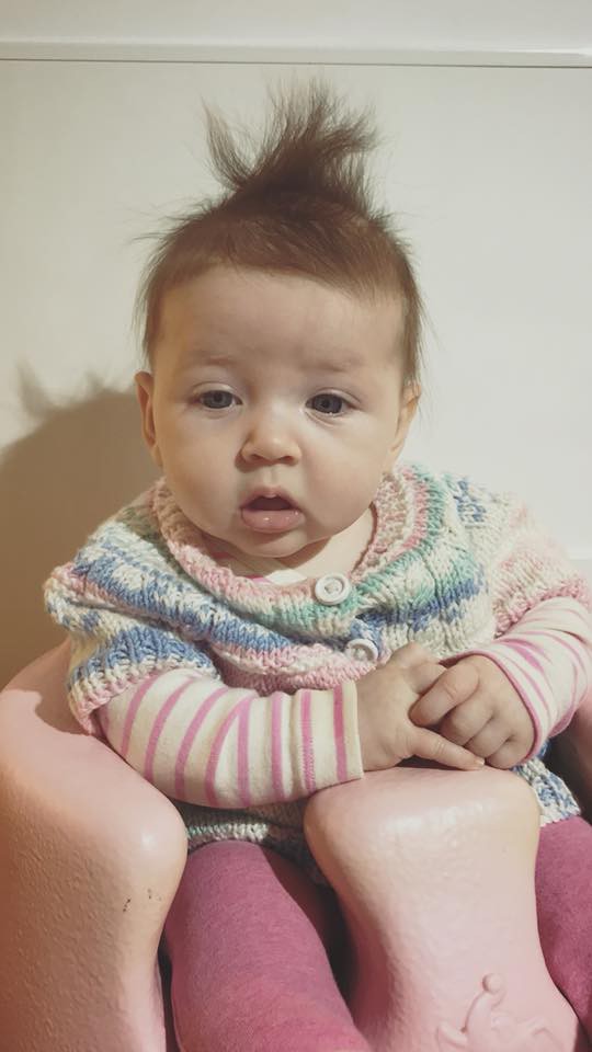 Bé gái 5 tháng tuổi đột nhiên ngừng thở vì căn bệnh rất phổ biến ở trẻ vào mùa đông - Ảnh 2.