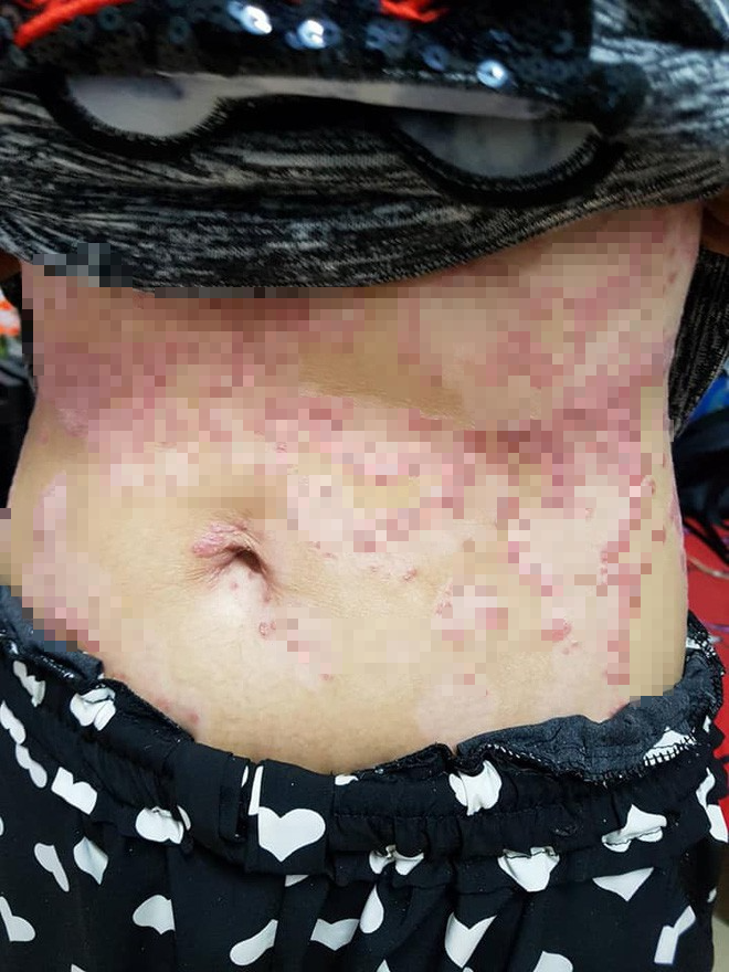 Chỉ vì mắc bệnh này mà người phụ nữ sau khi sinh không chỉ bị chồng bỏ rơi, mà còn bị sa thải - Ảnh 3.