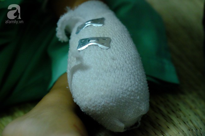 Tai nạn đau lòng: Bé trai 3 tuổi đứt lìa ba ngón tay vì nghịch máy xay bột làm nhang - Ảnh 4.