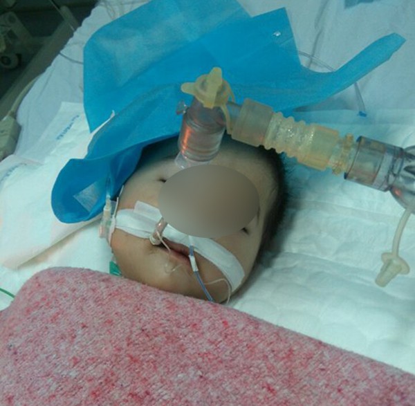 Đông Anh: Bé gái nguy kịch sau mũi tiêm nghi bị nhầm thuốc của nhân viên y tế - Ảnh 4.