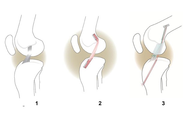 Trước 25 tuổi, đây là 5 vùng cơ thể bị già đi nhanh nhất mà con gái không hề nghĩ tới - Ảnh 2.