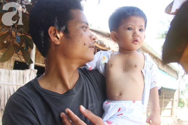 Lời khẩn cầu của người mẹ ôm con gái 2 tuổi bị hở van tim, chỉ nặng 6 ký mà không có tiền chạy chữa - Ảnh 13.