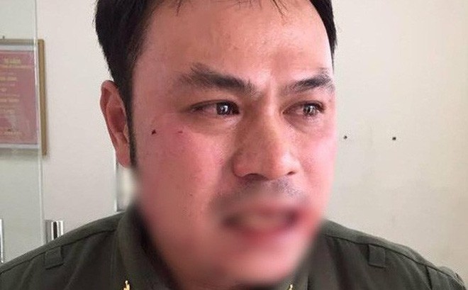 Tạm giữ hình sự người phụ nữ đánh gãy răng nhân viên an ninh Cảng hàng không Nội Bài - Ảnh 1.