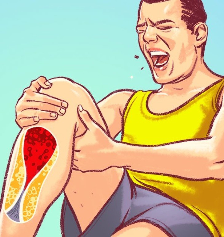 Những dấu hiệu trên cơ thể cảnh báo động mạch bị tắc nghẽn cần đặc biệt chú ý - Ảnh 1. Những dấu hiệu trên cơ thể cảnh báo động mạch bị tắc nghẽn cần đặc biệt chú ý - Ảnh 1.