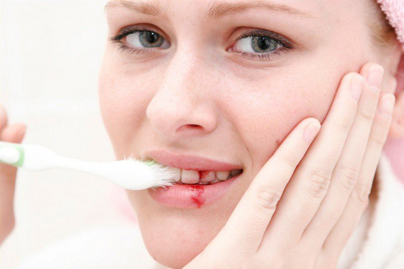 5 dấu hiệu bất thường ở vùng răng miệng có thể dự báo nhiều căn bệnh nguy hiểm mà bạn không lường trước được - Ảnh 2. 5 dấu hiệu bất thường ở vùng răng miệng có thể dự báo nhiều căn bệnh nguy hiểm mà bạn không lường trước được - Ảnh 2.