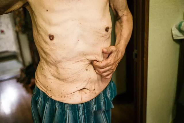 3 năm, 32 bức ảnh, nhiếp ảnh gia ghi lại quá trình trước khi cha từ giã cõi đời vì ung thư: Đừng để người thân một mình chống chọi - Ảnh 13.