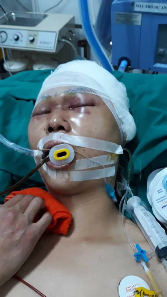 Hà Nội: Nam sinh cấp 3 bị nhóm người lạ đánh chấn thương sọ não ngay trước cổng nhà - Ảnh 1.