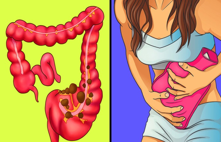 Đau vùng thắt lưng có thể là dấu hiệu cảnh báo một trong những vấn đề sức khỏe nguy hại sau - Ảnh 2. Đau vùng thắt lưng có thể là dấu hiệu cảnh báo một trong những vấn đề sức khỏe nguy hại sau - Ảnh 2.