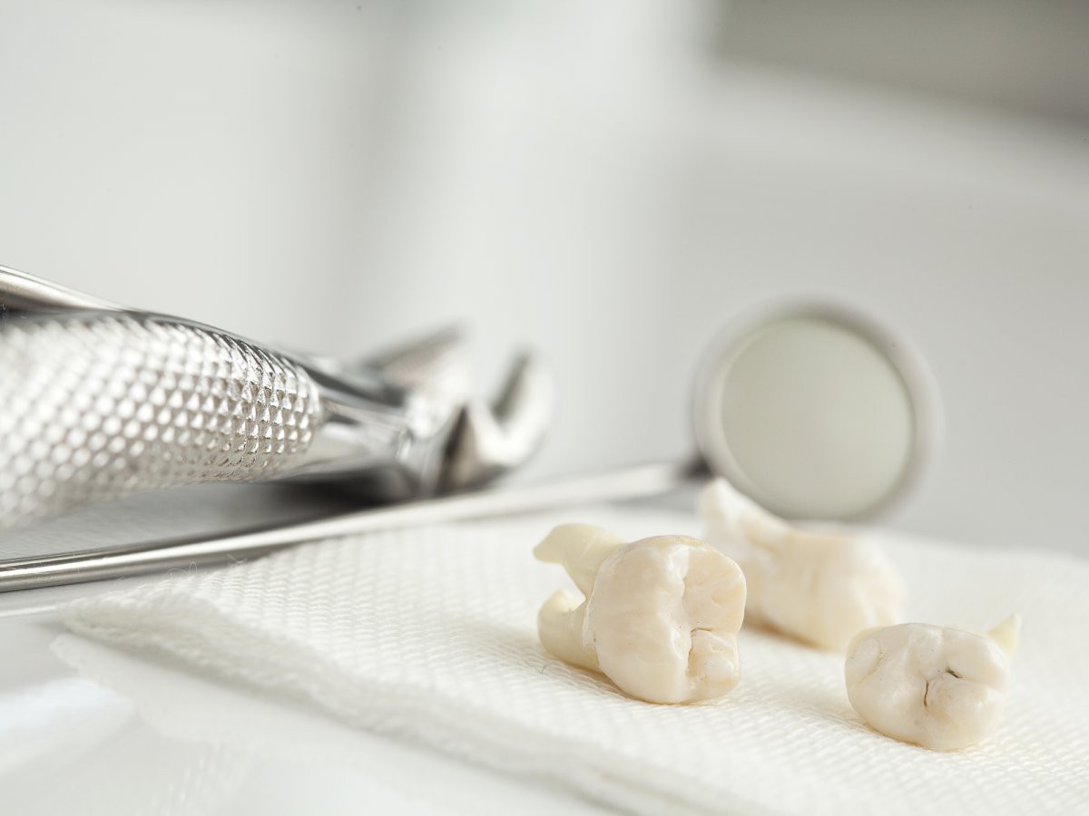 9 bộ phận cơ thể giờ đ&acirc;y con người kh&ocirc;ng cần d&ugrave;ng đến nữa, đặc biệt nhất l&agrave; c&aacute;i cuối c&ugrave;ng - Ảnh 3.