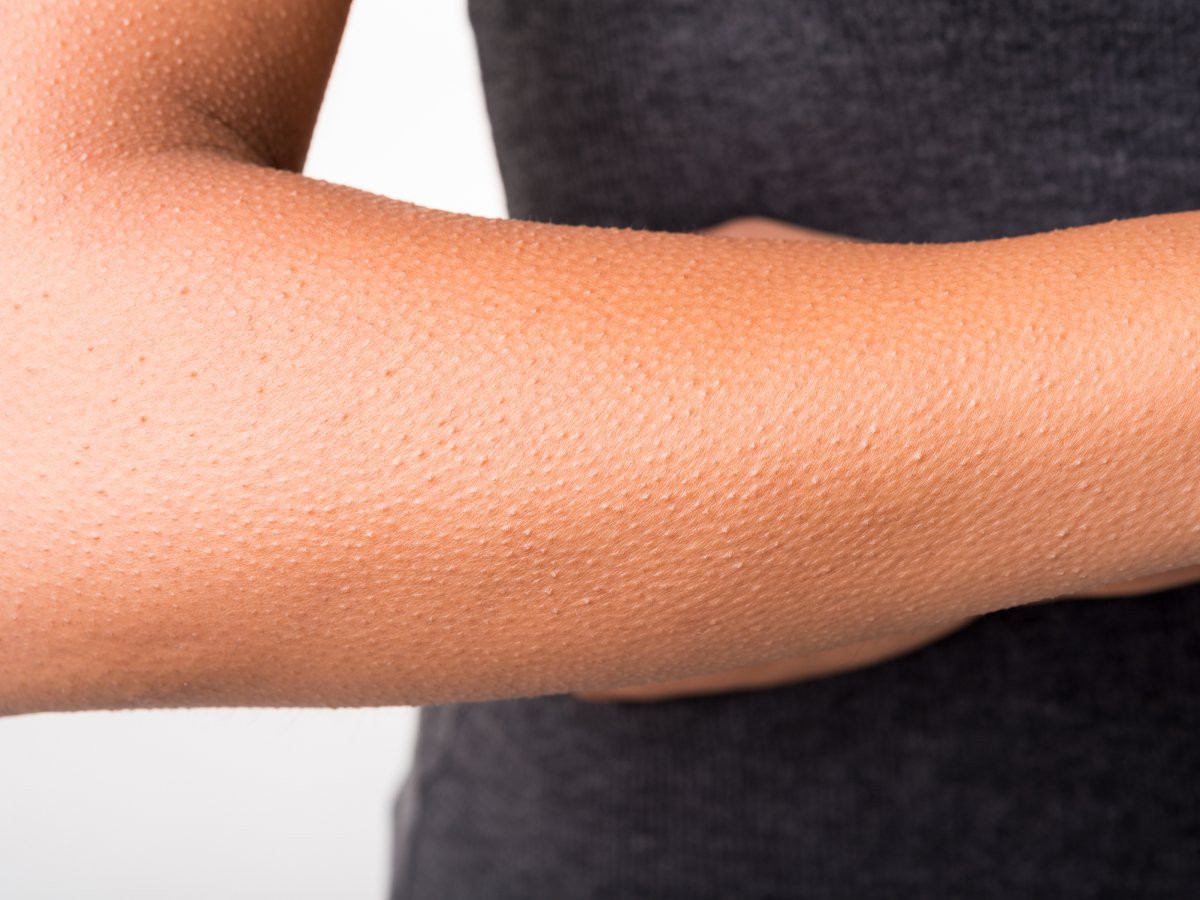 9 bộ phận cơ thể giờ đ&acirc;y con người kh&ocirc;ng cần d&ugrave;ng đến nữa, đặc biệt nhất l&agrave; c&aacute;i cuối c&ugrave;ng - Ảnh 4.