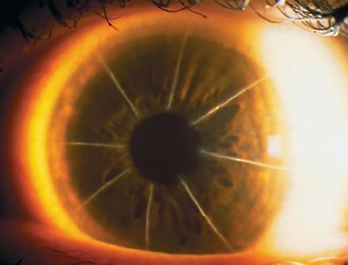 Bệnh nhân với con mắt siêu hiếm trông như bánh pizza 8 miếng: Minh chứng cho thấy y học đã từng đáng sợ như thế nào - Ảnh 3.