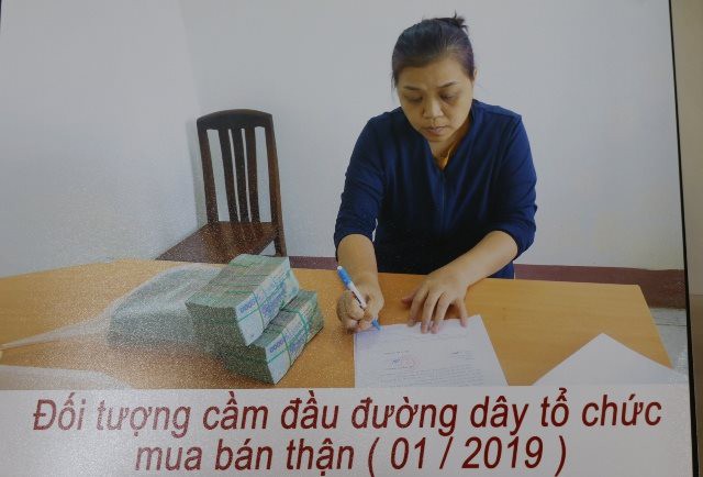Triệt phá đường dây tổ chức bán thận thu lợi hàng chục tỉ đồng - Ảnh 2.