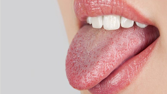 5 triệu chứng bất thường ở răng miệng cảnh báo nhiều vấn đề nguy hại mà bạn không nên chủ quan bỏ qua - Ảnh 3.