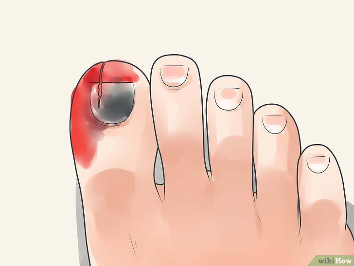 Ноющие боли пальцев ног