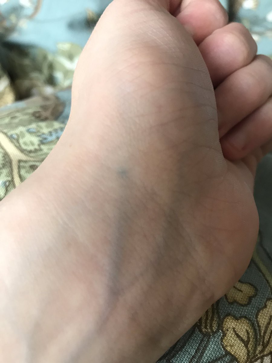 Bố mẹ cấm xăm nhưng cả nghìn dân mạng đều có chung 1 hình từ hồi bé, lý do gì vậy? - Ảnh 9. Bố mẹ cấm xăm nhưng cả nghìn dân mạng đều có chung 1 hình từ hồi bé, lý do gì vậy? - Ảnh 9.