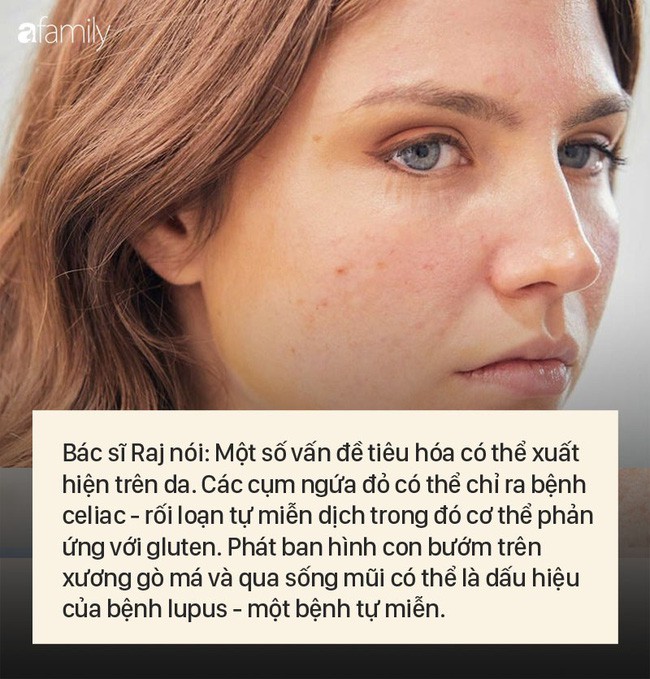 8 dấu hiệu cảnh báo bệnh được “khắc” rất rõ trên khuôn mặt của bạn - Ảnh 7.