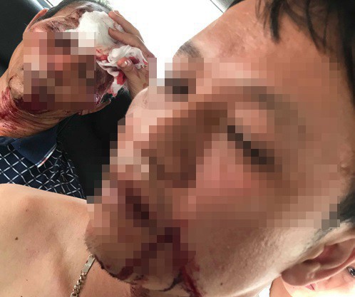 Vụ 3 người bị bắn trọng thương khi đang ăn cơm ở Thanh Hoá: Do mâu thuẫn giữa 2 nữ sinh lớp 7 - Ảnh 2.
