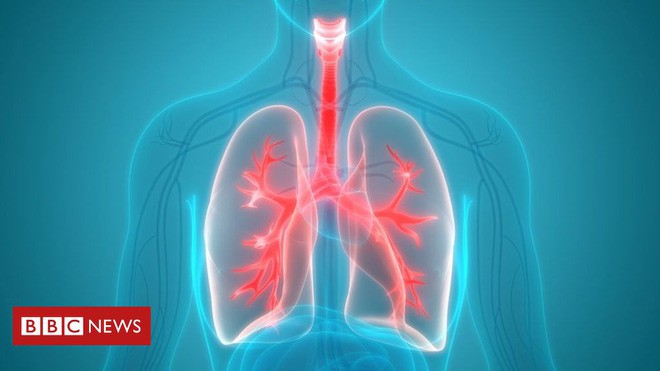 Nghiên cứu cho thấy người béo phì có thể chết đuối trong chính chất béo của họ - Ảnh 2.