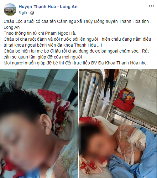 Xác minh thông tin bé trai ở Long An bị cha đẻ bạo hành, đổ nước sôi khiến bỏng nặng phải nhập viện - Ảnh 1.