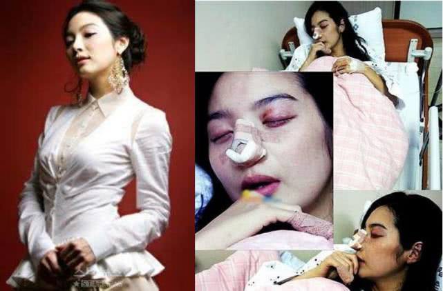 Rộ tin Lâm Chí Linh lấy chồng được 4 tháng đã bị đánh đến mức nhập viện và sự thật đằng sau - Ảnh 4.