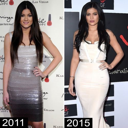 Chị em Kendall và Kylie Jenner lâu lắm mới đọ body trực diện, so với ảnh quá khứ đúng là một trời một vực - Ảnh 5.