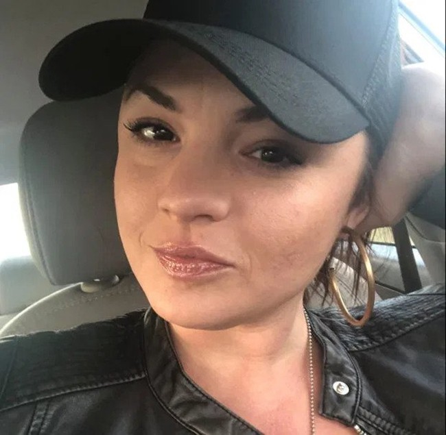 Mở nắp l&ograve; BBQ để chuẩn bị nướng thịt, người phụ nữ bị bỏng khắp mặt v&agrave; người do ngọn lửa ch&aacute;y &acirc;m ỉ l&acirc;u ng&agrave;y - Ảnh 2.