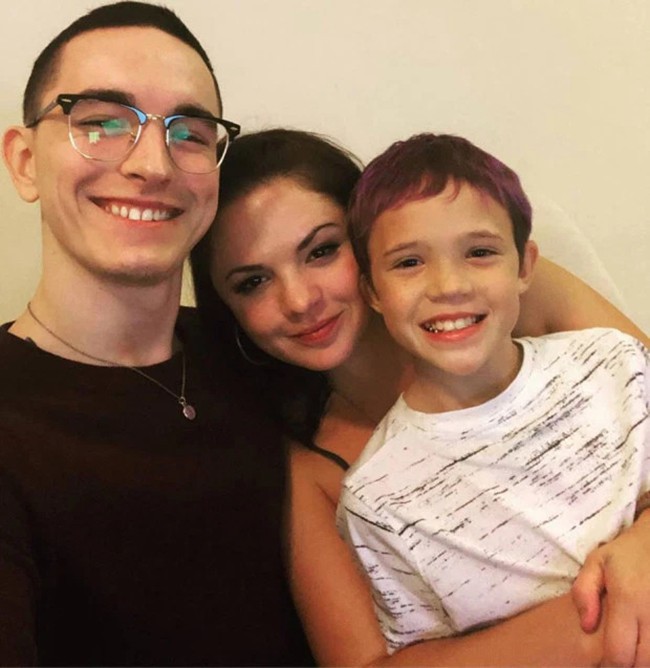 Mở nắp l&ograve; BBQ để chuẩn bị nướng thịt, người phụ nữ bị bỏng khắp mặt v&agrave; người do ngọn lửa ch&aacute;y &acirc;m ỉ l&acirc;u ng&agrave;y - Ảnh 3.