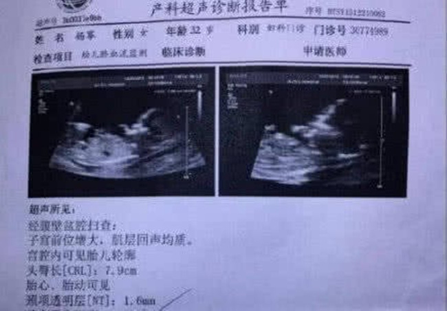 Xôn xao tin đồn Dương Mịch đã mang thai với Tạ Đình Phong, sắp sửa công khai tình cảm - Ảnh 4.