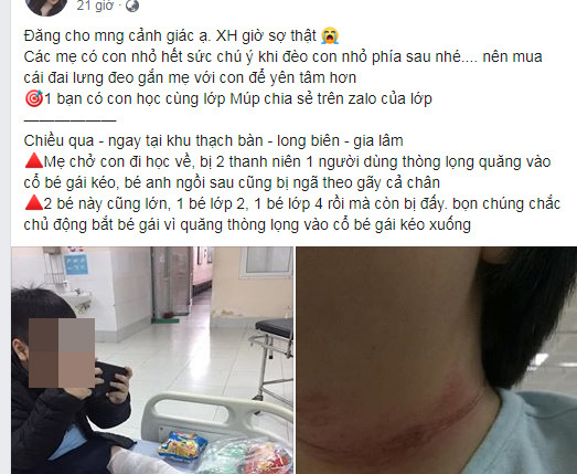 Hà Nội: Sự thật về thông tin 2 cháu bé ngồi sau xe mẹ ngã gãy chân vì bị thanh niên thòng dây vào cổ - Ảnh 3.