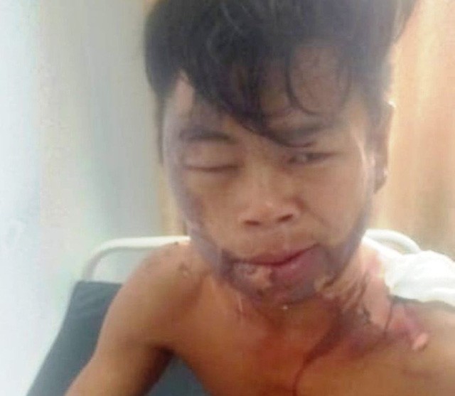 Tiết lộ bất ngờ của &ocirc;ng bố c&oacute; con g&aacute;i tưới nước s&ocirc;i l&ecirc;n người con trai - Ảnh 1.