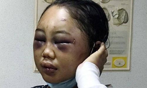  Thiếu nữ Indonesia làm osin ở Hong Kong: Bị lột đồ, hành hạ đến thân tàn ma dại và vấn nạn đau đầu về luật bảo vệ người giúp việc ở nước ngoài  - Ảnh 5.