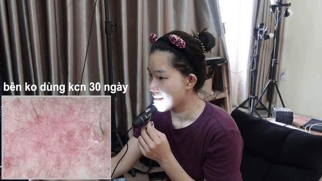 B&ocirc;i kem chống nắng 1/2 khu&ocirc;n mặt trong 30 ng&agrave;y, mẹ bỉm sữa thấy r&otilde; sự ch&ecirc;nh lệch: B&ecirc;n th&igrave; trắng mịn, b&ecirc;n sạm th&acirc;m kh&ocirc;ng đều m&agrave;u - Ảnh 10.