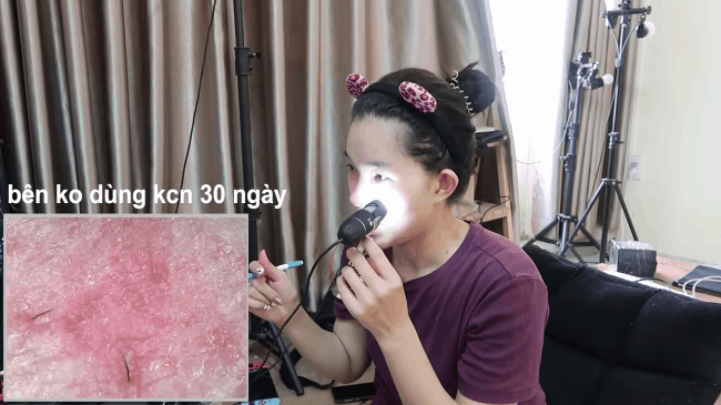 B&ocirc;i kem chống nắng 1/2 khu&ocirc;n mặt trong 30 ng&agrave;y, mẹ bỉm sữa thấy r&otilde; sự ch&ecirc;nh lệch: B&ecirc;n th&igrave; trắng mịn, b&ecirc;n sạm th&acirc;m kh&ocirc;ng đều m&agrave;u - Ảnh 9.