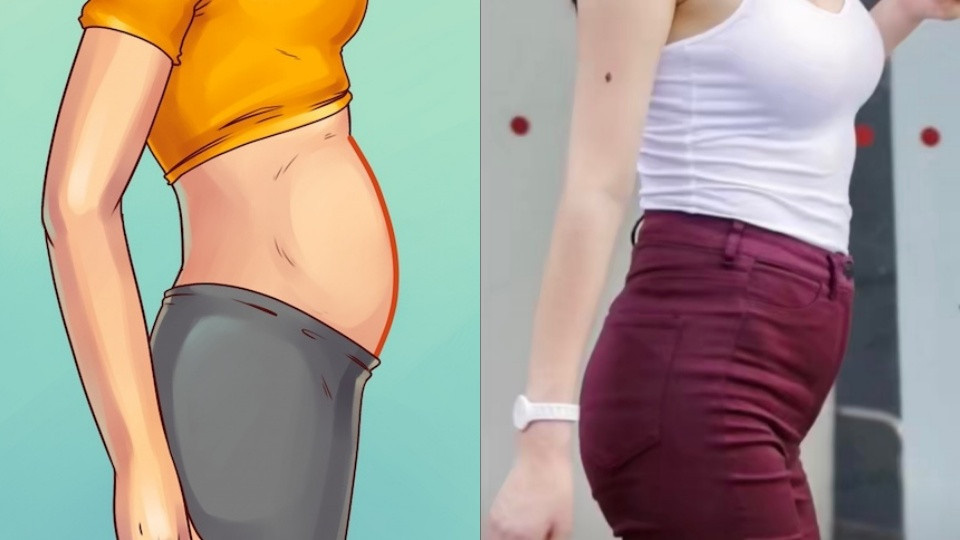 C&oacute; 3 kiểu b&eacute;o bụng kh&ocirc;ng phải do thừa c&acirc;n, b&eacute;o ph&igrave; m&agrave; ngầm cảnh b&aacute;o một v&agrave;i căn bệnh kh&aacute;c - Ảnh 1.