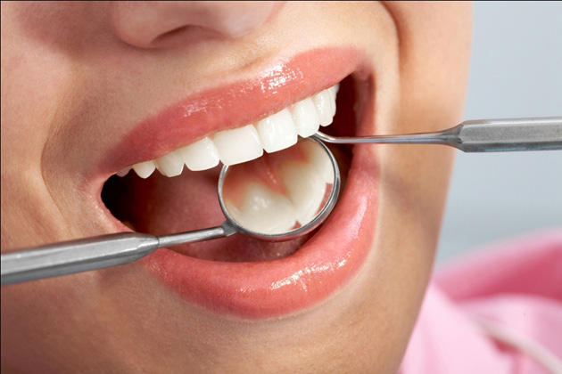 Những thói quen cần tránh khi vệ sinh răng miệng - Ảnh 4.