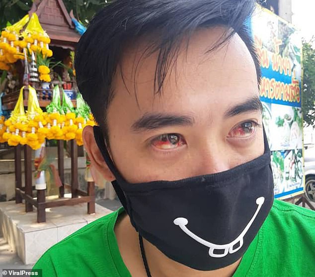 Thái Lan: Ô nhiễm quá nặng tại Bangkok khiến nhiều người dân ho ra máu - Ảnh 3.