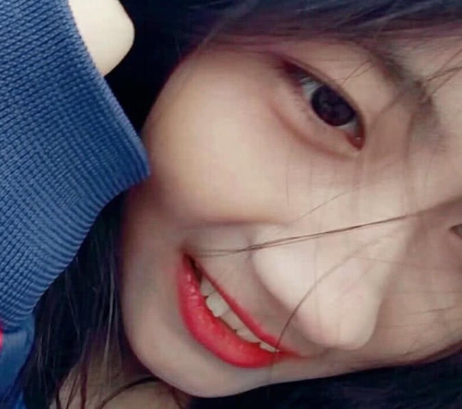 Nữ sinh viên thể dục khiến mọi người nể phục vì bị chấn thương nghiêm trọng vẫn chỉ lo lắng việc luyện tập - Ảnh 4. Nữ sinh viên thể dục khiến mọi người nể phục vì bị chấn thương nghiêm trọng vẫn chỉ lo lắng việc luyện tập - Ảnh 4.