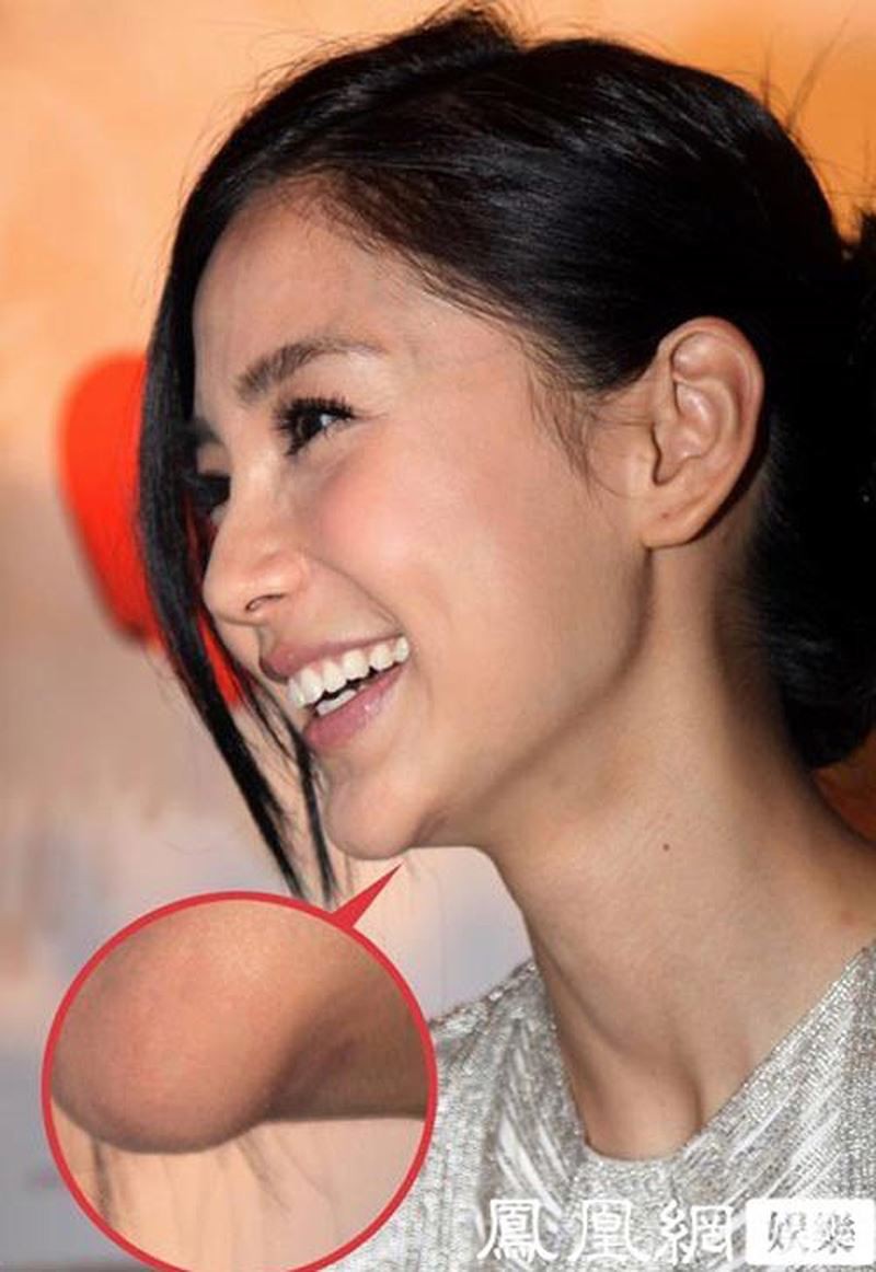 Loạt hình góc nghiêng gây bão của dàn sao châu Á: Người đẹp như tiên nữ, kẻ lộ dấu vết dao kéo - Ảnh 16. Loạt hình góc nghiêng gây bão của dàn sao châu Á: Người đẹp như tiên nữ, kẻ lộ dấu vết dao kéo - Ảnh 16.