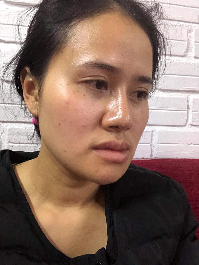 Bị chồng bỏ v&igrave; xấu, bị c&ocirc; g&aacute;i trẻ đẹp n&oacute;i 1 c&acirc;u cay nghiệt, người phụ nữ chấp nhận đau đớn để thay đổi - Ảnh 3.