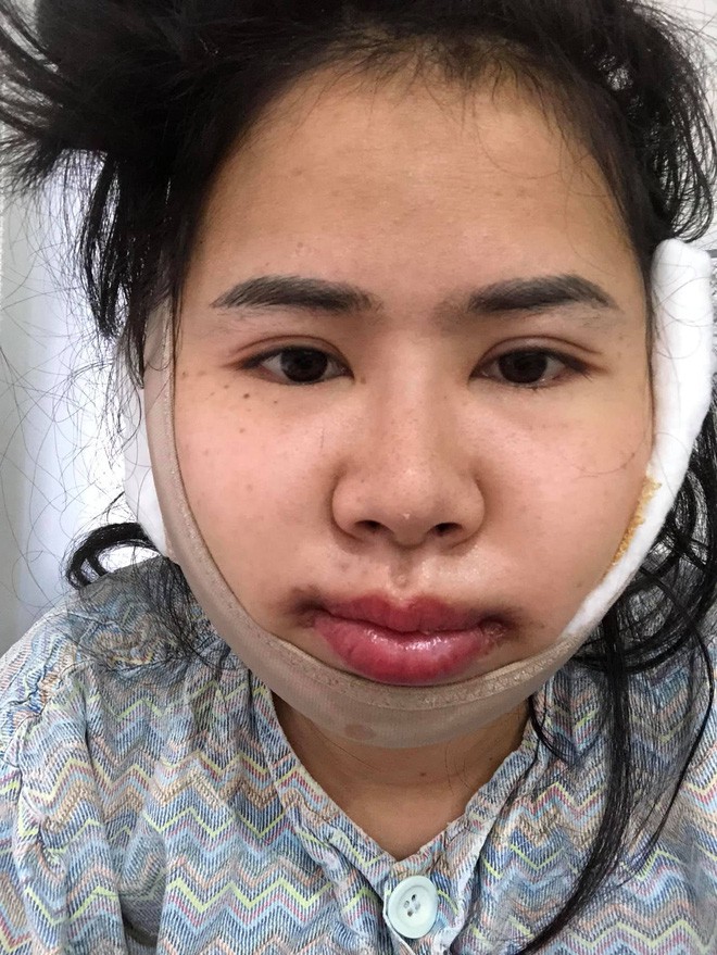 Bị chồng bỏ v&igrave; xấu, bị c&ocirc; g&aacute;i trẻ đẹp n&oacute;i 1 c&acirc;u cay nghiệt, người phụ nữ chấp nhận đau đớn để thay đổi - Ảnh 4.