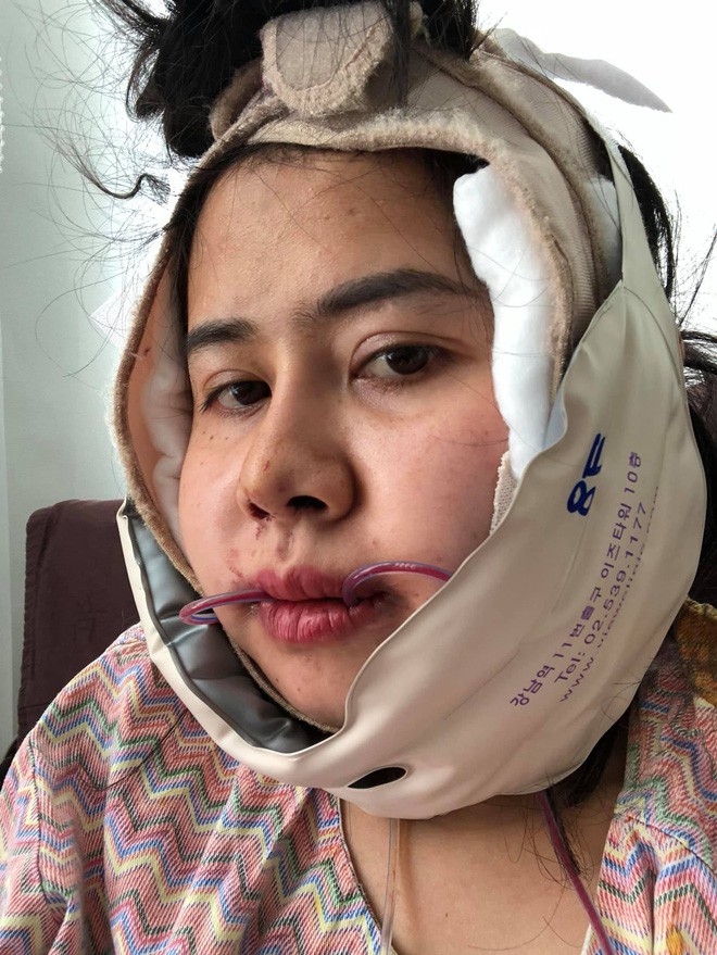 Bị chồng bỏ v&igrave; xấu, bị c&ocirc; g&aacute;i trẻ đẹp n&oacute;i 1 c&acirc;u cay nghiệt, người phụ nữ chấp nhận đau đớn để thay đổi - Ảnh 5.