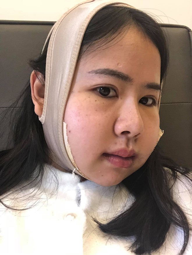 Bị chồng bỏ v&igrave; xấu, bị c&ocirc; g&aacute;i trẻ đẹp n&oacute;i 1 c&acirc;u cay nghiệt, người phụ nữ chấp nhận đau đớn để thay đổi - Ảnh 6.