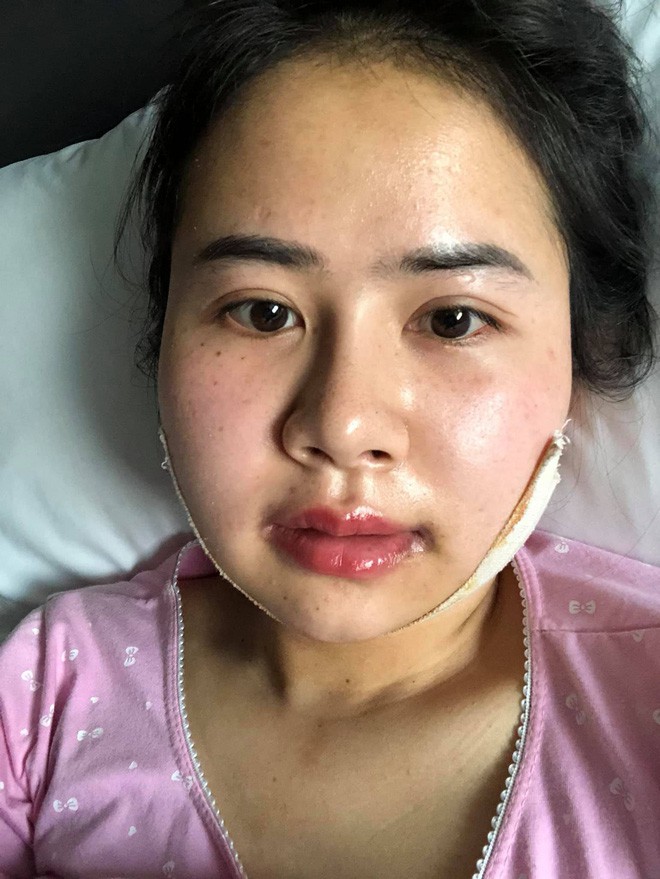 Bị chồng bỏ v&igrave; xấu, bị c&ocirc; g&aacute;i trẻ đẹp n&oacute;i 1 c&acirc;u cay nghiệt, người phụ nữ chấp nhận đau đớn để thay đổi - Ảnh 7.