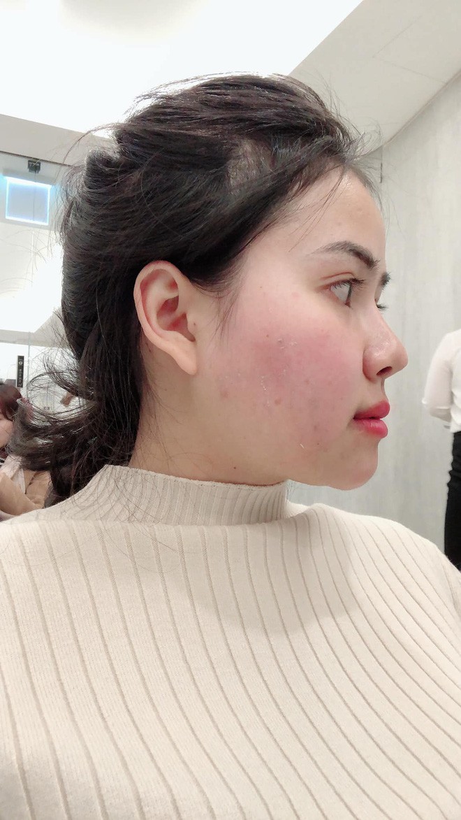 Bị chồng bỏ v&igrave; xấu, bị c&ocirc; g&aacute;i trẻ đẹp n&oacute;i 1 c&acirc;u cay nghiệt, người phụ nữ chấp nhận đau đớn để thay đổi - Ảnh 8.