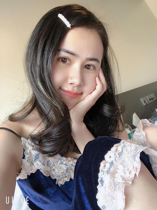 Bị chồng bỏ v&igrave; xấu, bị c&ocirc; g&aacute;i trẻ đẹp n&oacute;i 1 c&acirc;u cay nghiệt, người phụ nữ chấp nhận đau đớn để thay đổi - Ảnh 9.