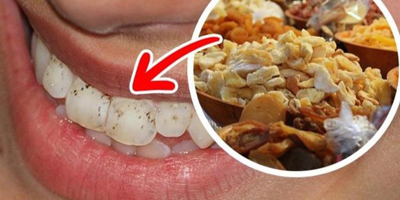 Những nguyên nhân không ngờ khiến răng bị ê buốt mà bạn không hề hay biết - Ảnh 1. Những nguyên nhân không ngờ khiến răng bị ê buốt mà bạn không hề hay biết - Ảnh 1.